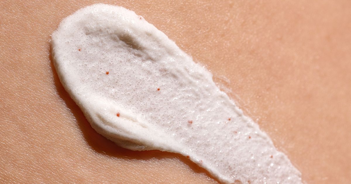 Creme para estrias funciona? Como escolher o produto certo