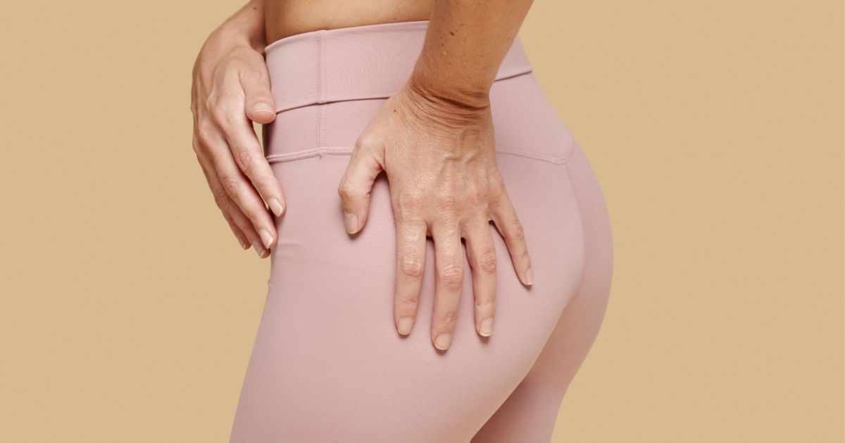 Estrias no Bumbum: Por Que Aparecem e Como Clarear