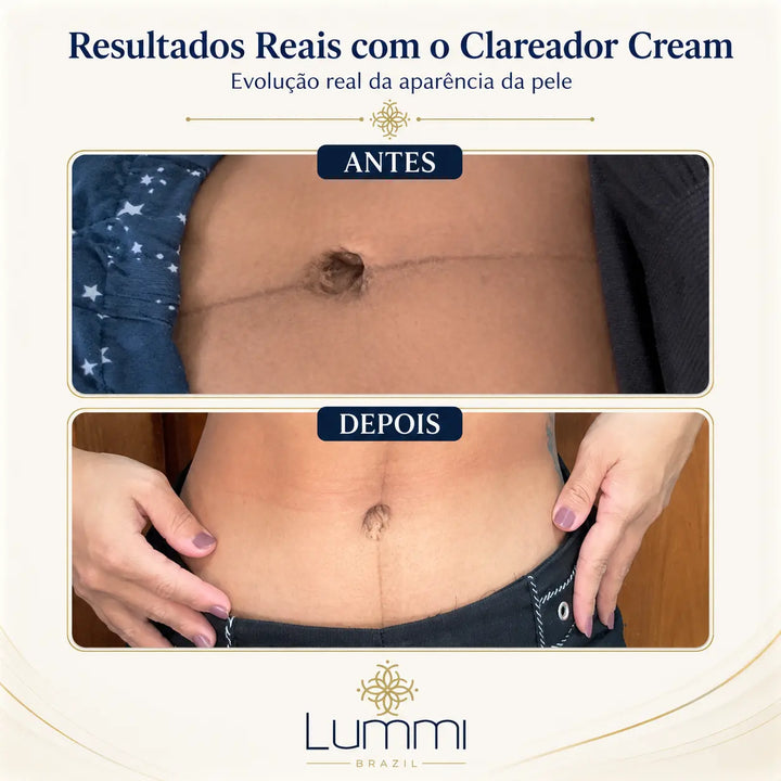 Clareador Cream — Circuito Clareador 4E™ para Áreas Sensíveis
