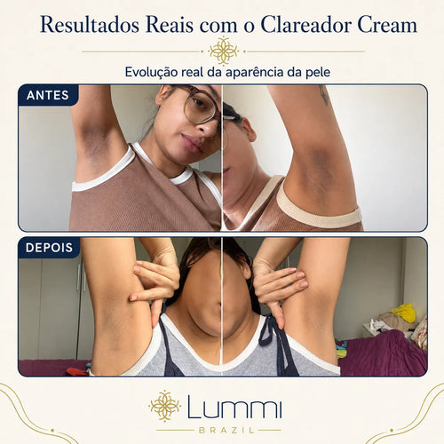 Clareador Cream — Circuito Clareador 4E™ para Áreas Sensíveis