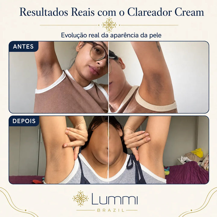 Clareador Cream — Circuito Clareador 4E™ para Áreas Sensíveis