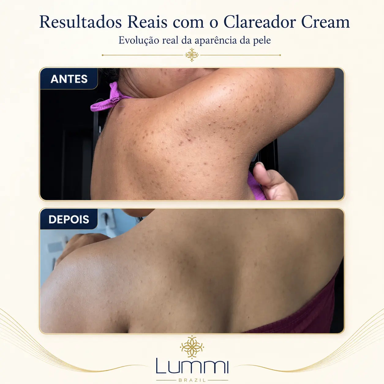 Clareador Cream — Circuito Clareador 4E™ para Áreas Sensíveis