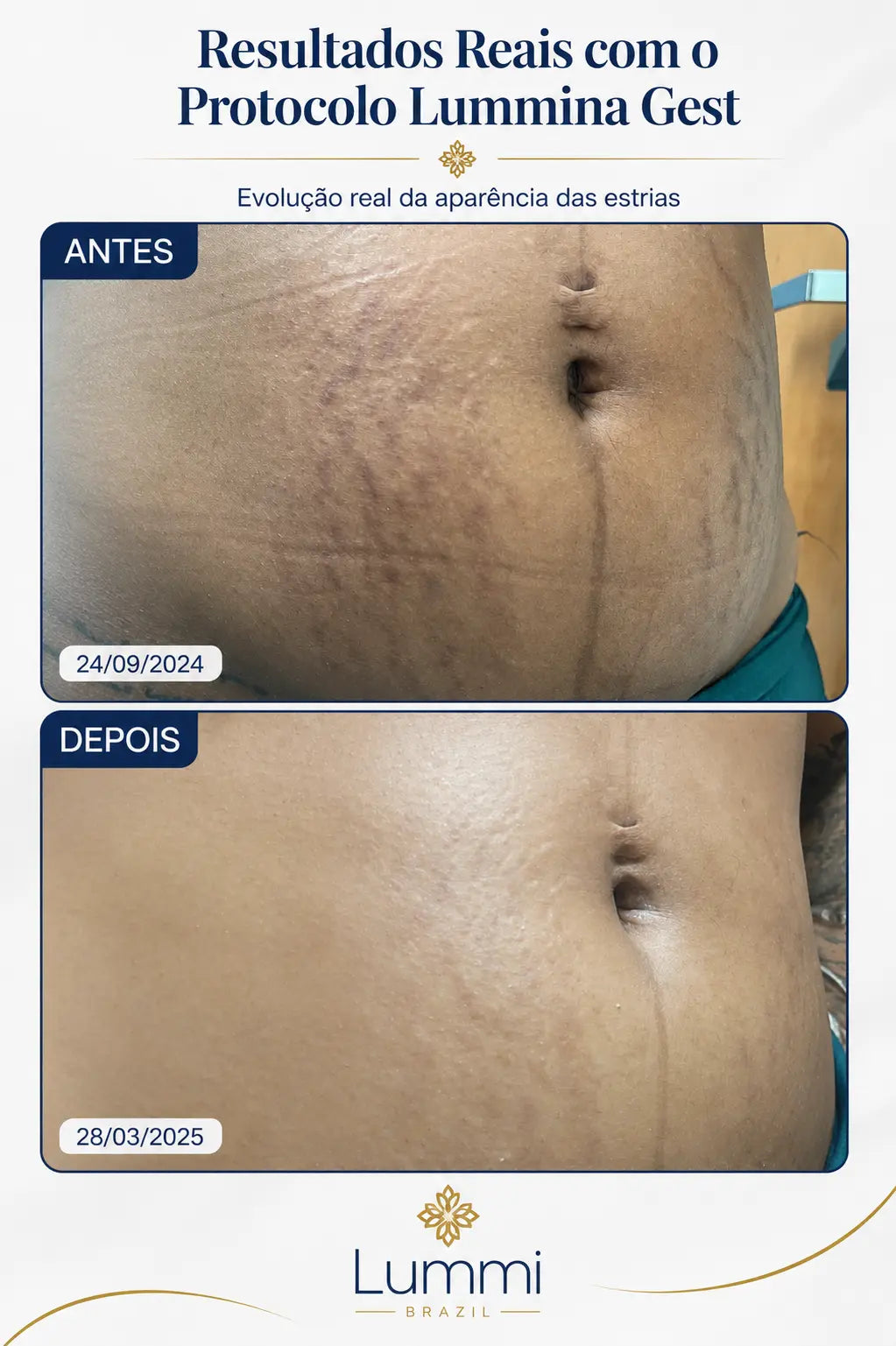 Lummina Gest - imagem 5