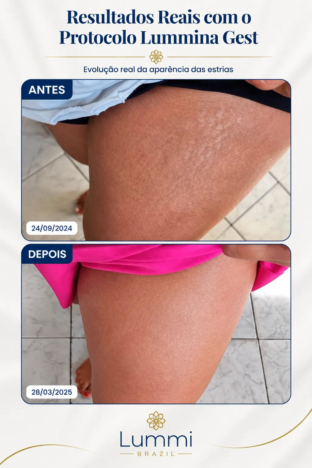 Lummina Gest - imagem 6